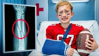 Levi Broke His Arm..