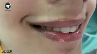 Same Day Smile