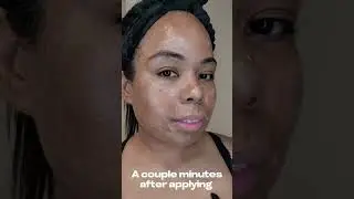 The Zombie Skincare Trend You Shouldn't Ignore
