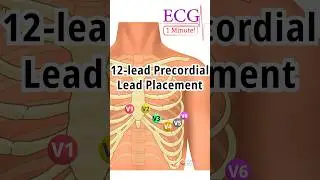 1 Minute ECG: 12-Lead Precordial Lead Placement