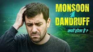 Dandruff in Monsoon: Main Reasons & How to Control It 🤔 | Hindi