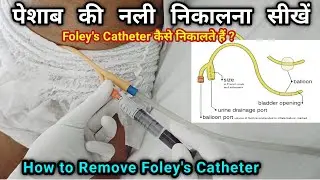 How to remove Urinary Catheter || How to remove Foley's Catheter || How to remove Foley's Catheter