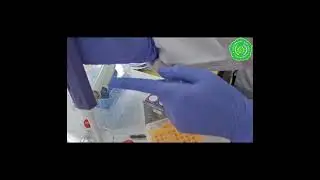 Tugas Video MK Hematologi Patologi Kelompok B1 &ldquo;Pemeriksaan Serum FE&rdquo;
