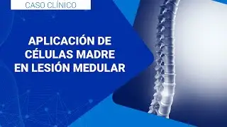Aplicación de Células Troncales Mesenquimales en Lesión Modular | RCG