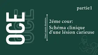 Odontologie conservatrice || Schéma clinique d'une lésion carieuse (part1)