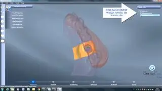 DentalCAD - Implant (OLD VERSION)