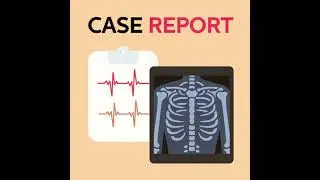 [Case Report] 46yo with psychosis and cold intolerance