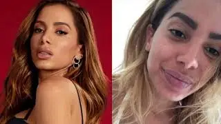 22 Famosas sem maquiagem