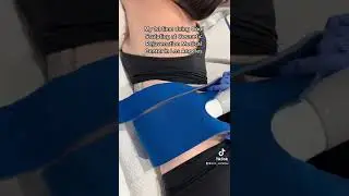 My 1st time doing Cool Sculpting 🧊