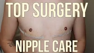 Top Surgery Nipple Care