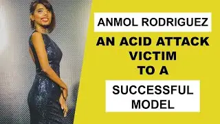 Most Inspirational Story: An Acid Attack Victim To A Successful Model | Anmol Rodriguez