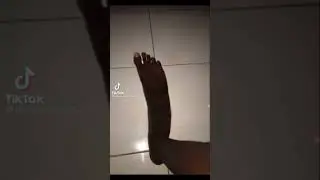 Black feet