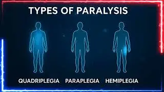 Paralysis &ndash; Signs & Treatment