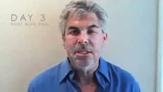 Dr. Jed Horowitz Has Obagi Blue Peel (Chemical Face Peel) Day 3