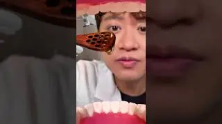 Dentist scoops HONEY from your teeth?! #asmr