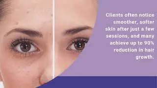 The Benefits of El Paso Permanent Hair Removal at American Laser Med Spa