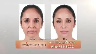Facial & Neck Rejuvenation