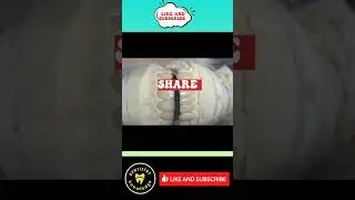#dentistryknowledge#dentist#world#tooth#bridge#restoration#smile#shorts#youtube#viral#top#instagram#