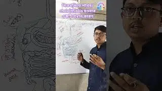 পিত্তথলিতে পাথর/cholelithiasis হওয়ার একটি প্রধান কারণ #healthtipsbango