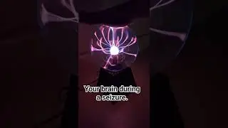 Seizure activity in a brain!