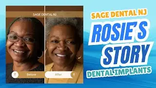 ROSIE'S STORY - DENTAL IMPLANTS AT SAGE DENTAL NJ
