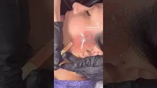 Sideburn waxing using Dermwax #satisfying #foryoupage #shortsfeed #waxing #sideburnwax #hairremoval