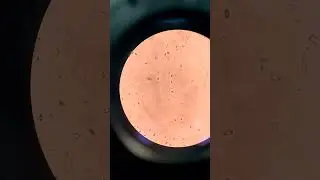 Fungal spores under Microscope #spores #cellculture #fungus