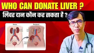Who Can Donate Liver? | लिवर कौन दान कर सकता है | Liver Donation Ka Criteria ?