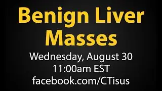 Facebook Live: Benign Liver Masses