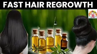 Fast Hair Regrowth | Transform Your Hair Growth Quickly with These Miracle Oils!