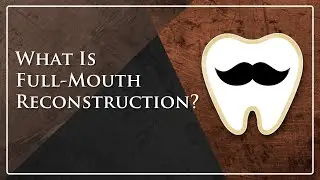 What Is Full-Mouth Reconstruction? | Atkins Dental Clinic | Dr. Aaron Bratton
