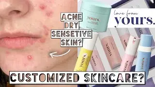 CUSTOM SKINCARE FOR ACNE, DRY, SENSITIVE SKIN | Love From Yours Review
