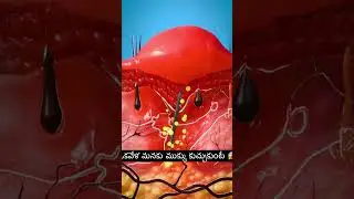 మనకు ముళ్ళు కుచ్చుకుంటే 😱 #telugufacts #factsintelugu #telugu #తెలుగు