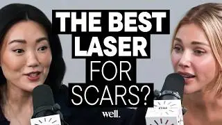 Amy Chang: The Best Laser Treatment for Acne & Scars