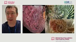 BHF Data Science Centre Research Showcase - Sessions 5 & 6