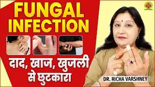Home Remedies for Fungal Infection | Acupressure Points for Itching