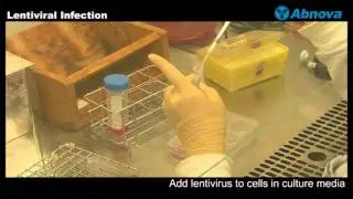 Lentiviral Infection