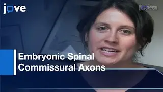 Assaying Ability Of Diffusible Signaling Molecules To Reorient Axons l Protocol Preview
