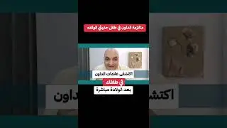 اكتشف علامات في طفلك بعد الولاده مباشره#دخالدكمال 