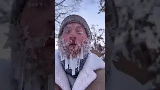 Альбертович : ЛИЦО В СОСУЛЬКАХ 🤣