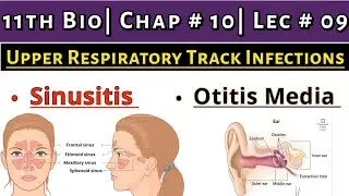 Upper Respiratory Track Infections || Explain Sinusitis & Otitis Media || 11th Bio| Ch # 10| Lec # 9