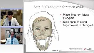 Percutaneous Procedures for Trigeminal Neuralgia Radiofrequency and Balloon Compression Rhizotomy