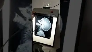 x ray ent prcatical