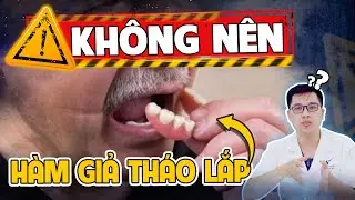 Hàm Giả Tháo Lắp: 3 Nhược Điểm 