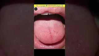 How Different Things Look Like Under A Microscope
