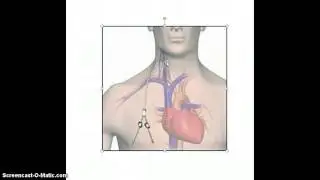 Venous Access
