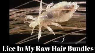 Lice In My Raw Hair Bundles