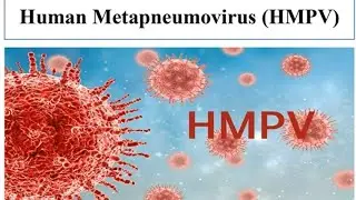 Human Meta Pneumovirus | HMPV | Sign and Symptoms and Manager of  of HMPV infections |