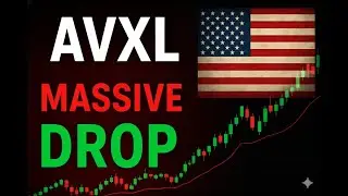 AVXL Stock CRASH: Anavex Life Sciences Plummets 35% on Regulatory Setback | News & Analysis