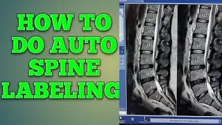 MRI Auto spine Labeling @spine ki labeling kese karte hai @Mri spine label@mri spine label